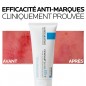 La Roche-Posay Cicaplast Baume Cicatrisant B5 Peau Fragilisée | 100 ml La Roche-Posay Cicaplast Baume Cicatrisant B5 Peau Fragilisée | 100 ml