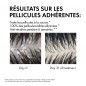 Vichy Dercos Shampoing Traitant Anti-Pelliculaire Cheveux Gras| 200 ml Vichy Dercos Shampoing Traitant Anti-Pelliculaire Cheveux Gras| 200 ml